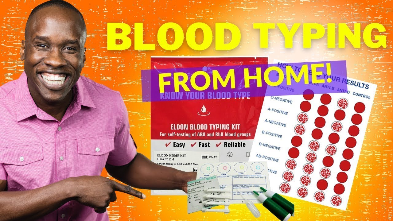How Do You Know What Your Blood Type Is? A Comprehensive Guide 2 how do you know what is your blood type